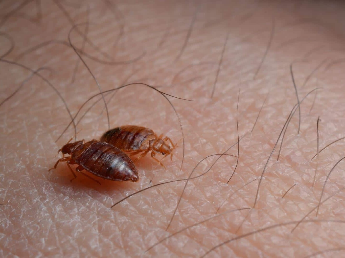 Top 25 sings of bed bugs